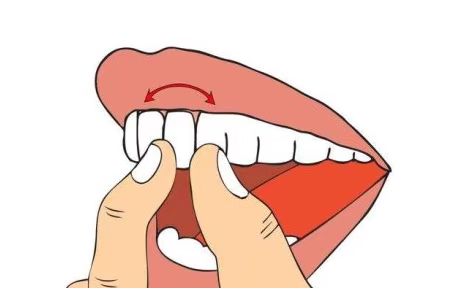 4940685.jpg 4940685.jpg